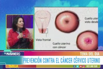 TEMA DEL DÍA: PREVENCIÓN CONTRA EL CÁNCER CÉRVICO UTERINO