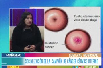 CÁNCER CERVICOUTERINO O CÁNCER DEL CUELLO DEL ÚTERO